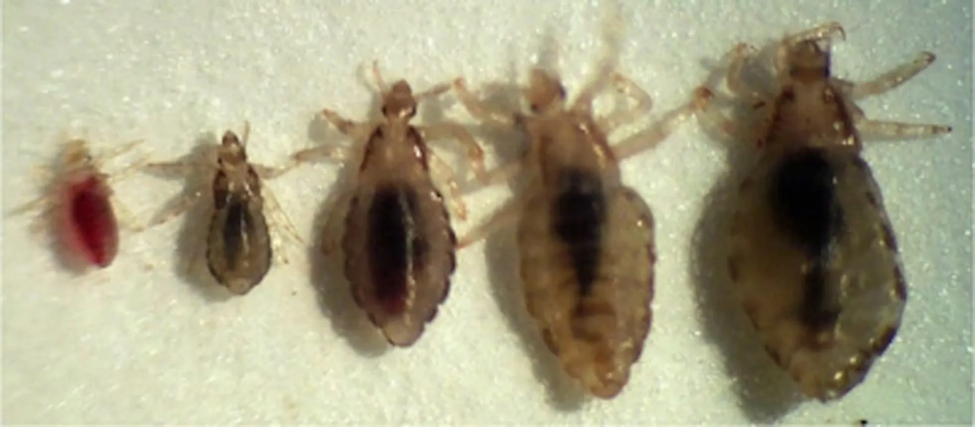 Detalle microscópico de la antena de un piojo humano